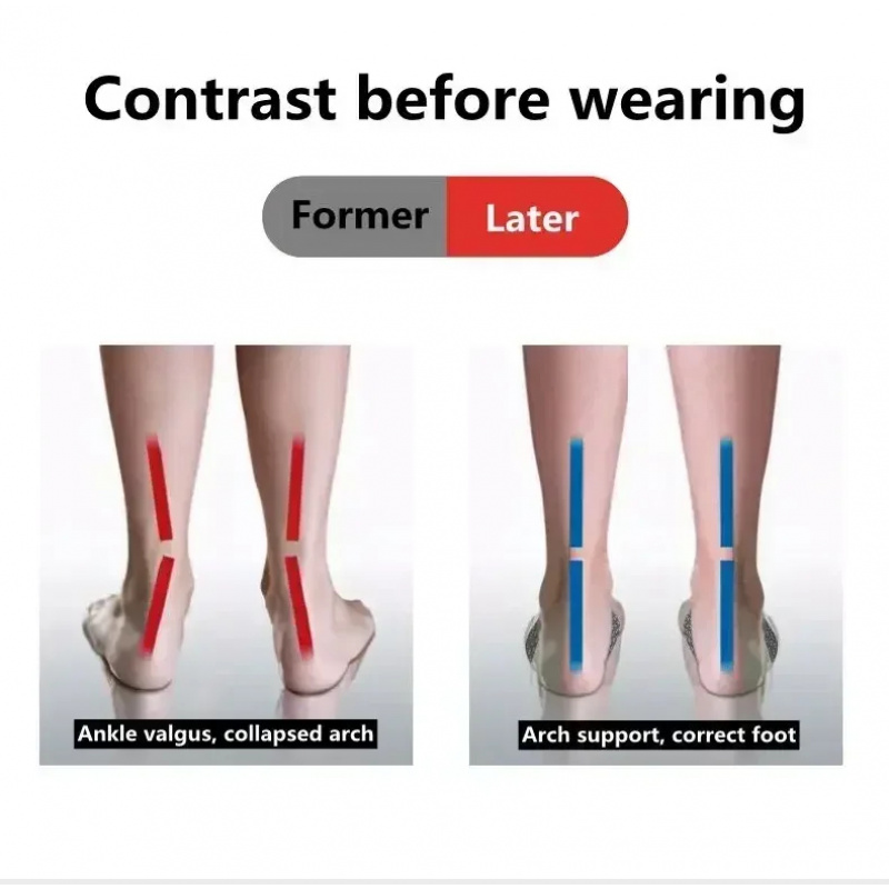 2 Pcs EVA Flat Feet Arch Suppo - Men Shoes Outlet บทวิจารณ์และราคา